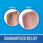 O'Keeffe's for Healthy Feet Foot Cream, Guaranteed Relief for Extremely Dry, Cracked Feet, Instantly Boosts Moisture Levels, 3.2 Ounce Jar, (Pack of 1) - Image 7
